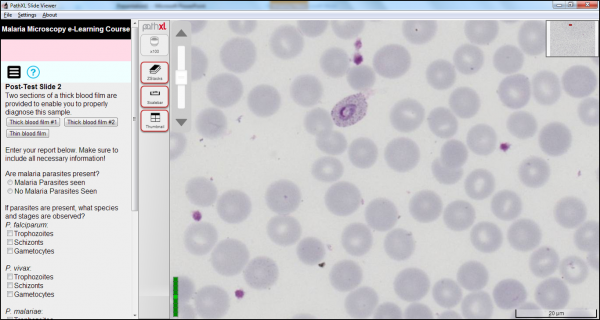 plasmodium microscope slide